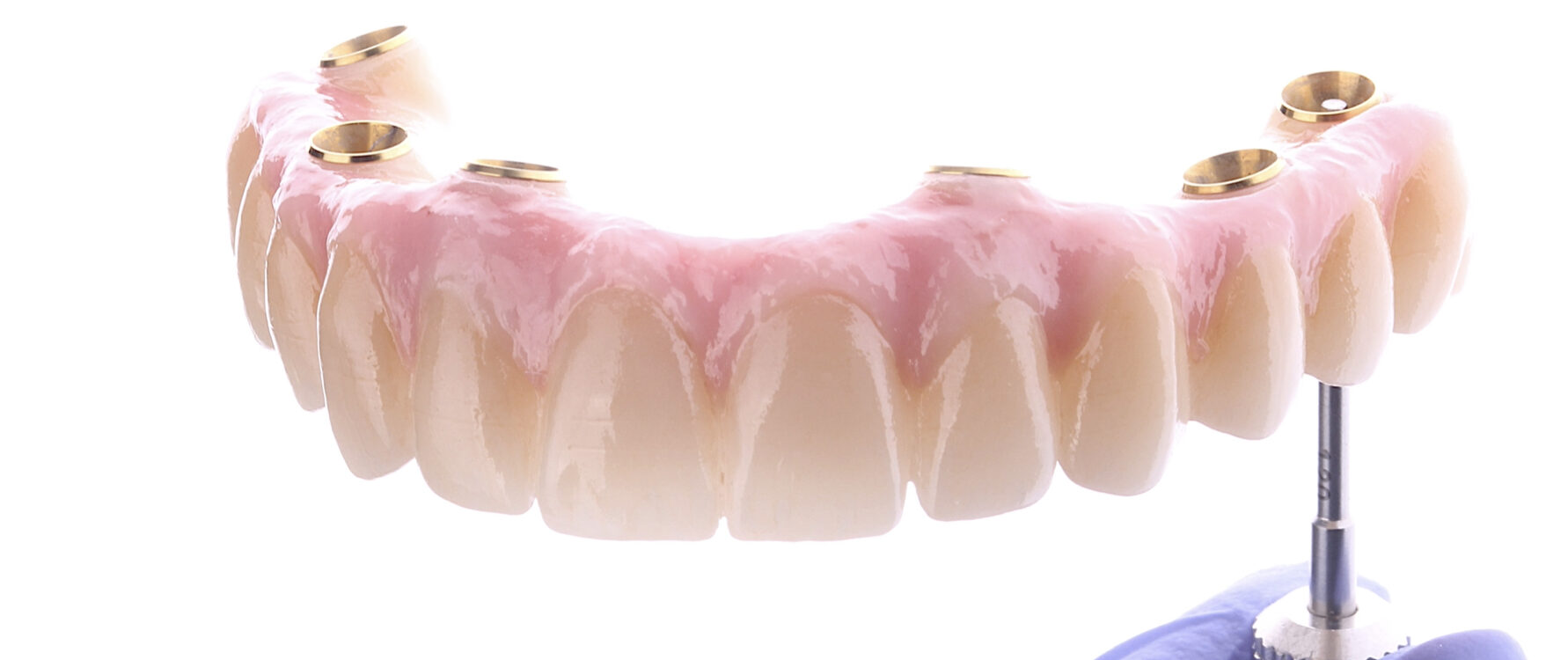 dentistas en madrid