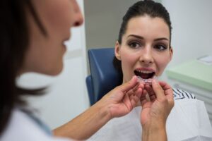 Qué son los retenedores dentales