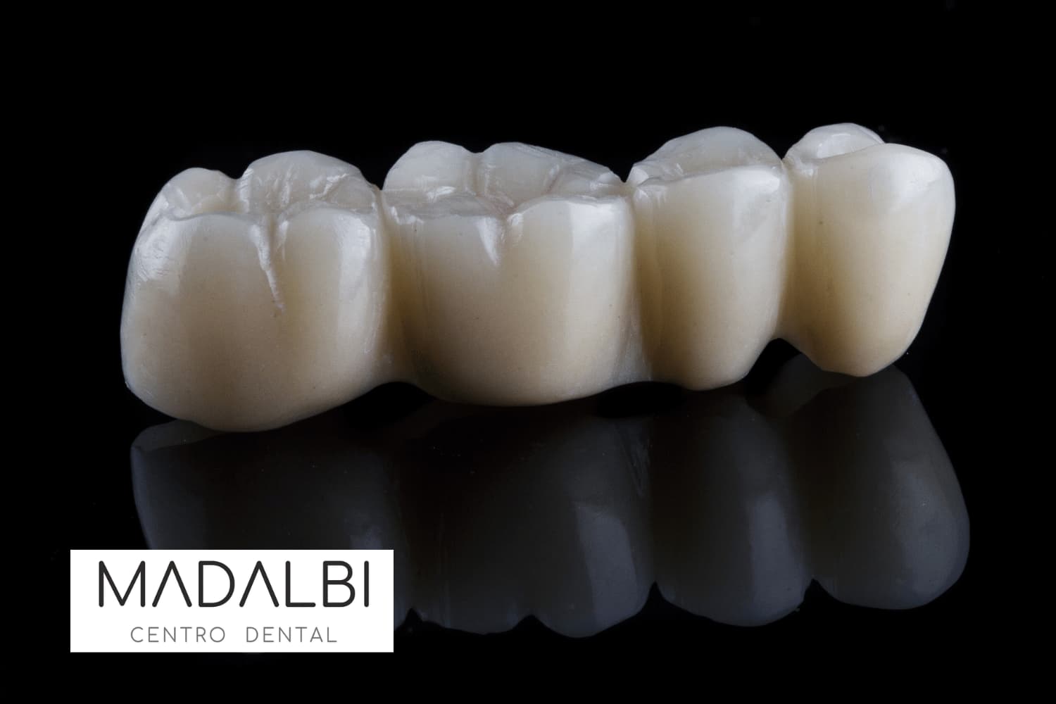 Puentes dentales Concepción